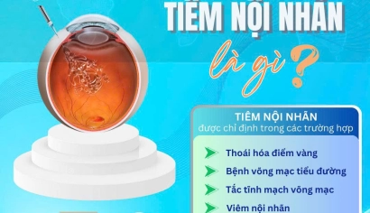 💉 TIÊM NỘI NHÃN – GIẢI PHÁP HIỆU QUẢ CHO BỆNH LÝ ĐÁY MẮT