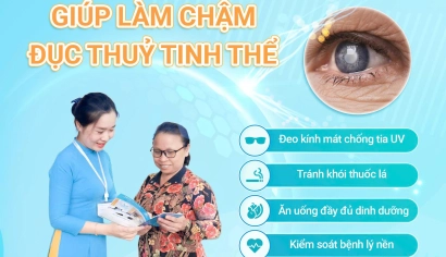 5 Thói Quen Giúp Làm Chậm Đục Thủy Tinh Thể